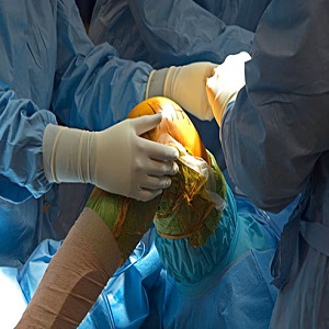 knee surgeon